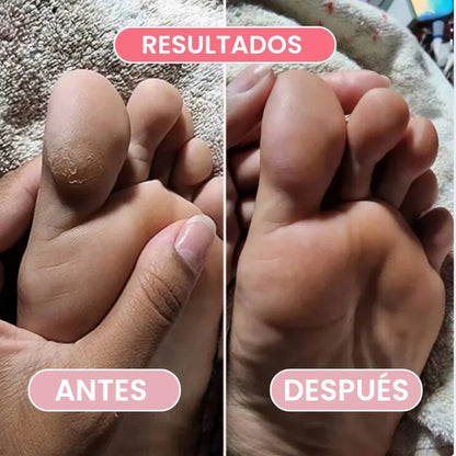Removedor de Callos eléctrico  - Pies Suaves